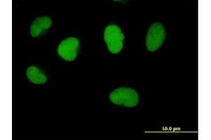 Immunofluorescence of purified MaxPab antibody to FBXO11 on HeLa cell.