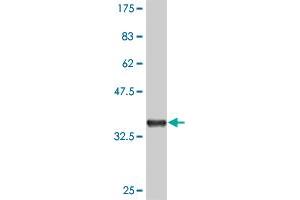 Western Blot detection against Immunogen (36. (MAPKAP Kinase 3 anticorps  (AA 59-153))