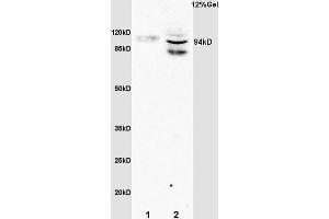 L1 rat brain lysates L2 rat liver lysates probed with Anti Phospho-STAT6(Tyr641) Polyclonal Antibody, Unconjugated (1791R) at 1:200 overnight at 4 °C. (STAT6 anticorps  (pTyr641))