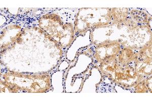 Detection of CXCR4 in Human Kidney Tissue using Polyclonal Antibody to Chemokine C-X-C-Motif Receptor 4 (CXCR4)