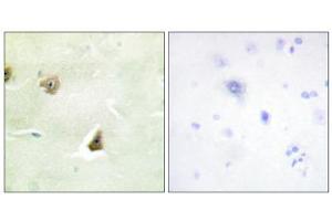 Immunohistochemistry analysis of paraffin-embedded human brain tissue, using DUSP6 antibody. (DUSP6 anticorps  (Internal Region))