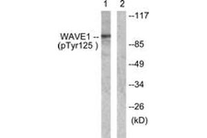 Western blot analysis of extracts from NIH-3T3 cells treated with Insulin 0. (WASF1 anticorps  (pTyr125))