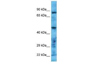 Host: Rabbit Target Name: TMPRSS11B Sample Type: Hela Whole Cell lysates Antibody Dilution: 1. (TMPRSS11B anticorps  (N-Term))