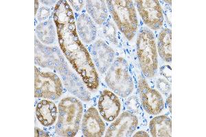 Immunohistochemistry of paraffin-embedded mouse kidney using GRPEL2 Rabbit pAb (ABIN6132810, ABIN6141437, ABIN6141438 and ABIN6224364) at dilution of 1:200 (40x lens).