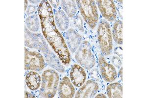 Immunohistochemistry of paraffin-embedded mouse kidney using GRPEL2 Rabbit pAb (ABIN6132810, ABIN6141437, ABIN6141438 and ABIN6224364) at dilution of 1:200 (40x lens). (GRPEL2 anticorps  (AA 33-225))