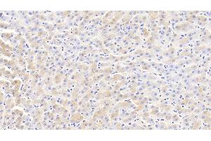 Detection of FTL in Bovine Liver Tissue using Polyclonal Antibody to Ferritin, Light Polypeptide (FTL)