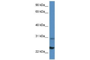 WB Suggested Anti-Rpl17 Antibody Titration: 1. (RPL17 anticorps  (N-Term))