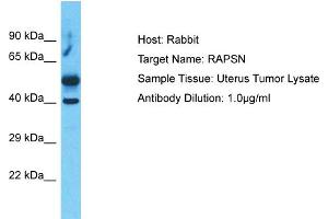 Host:  Rabbit  Target Name:  RAPSN  Sample Type:  Uterus Tumor lysates  Antibody Dilution:  1. (RAPSN anticorps  (C-Term))