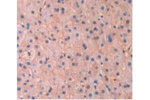Detection of APOA5 in Human Liver Tissue using Monoclonal Antibody to Apolipoprotein A5 (APOA5)