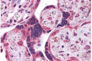 Human Placenta: Formalin-Fixed, Paraffin-Embedded (FFPE)