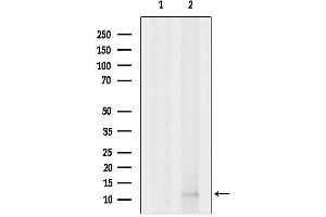 anti-Disrupted in Renal Carcinoma 1 (DIRC1) antibody