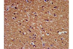 IHC image of ABIN7145619 diluted at 1:500 and staining in paraffin-embedded human brain tissue performed on a Leica BondTM system. (FHIT anticorps  (AA 2-147))