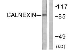 Western blot analysis of extracts from HeLa cells, treated with EGF 200ng/ml 30', using Calnexin (Ab-583) Antibody. (Calnexin anticorps  (AA 543-592))