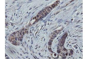 Image no. 6 for anti-Mitochondrial Ribosomal Protein S27 (MRPS27) (AA 151-414) antibody (ABIN1490969)