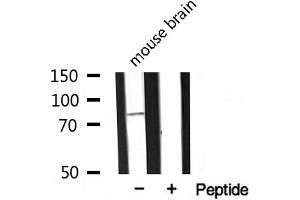 Western blot analysis of extracts from mouse Brian, using MARK2 antibody.