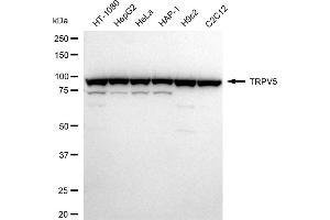 Western blotting analysis using TRPV5 antibody (ABIN7800610).