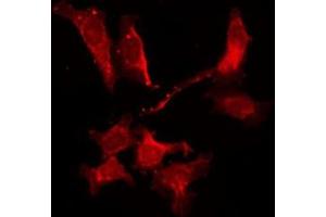 ABIN6278549 staining Hela by IF/ICC. (Adenosine A2b Receptor anticorps  (Internal Region))