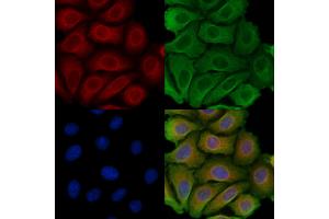 ABIN6257415 and ABIN6275226 staining Hela cells by IF/ICC. (PGRMC2 anticorps  (C-Term))