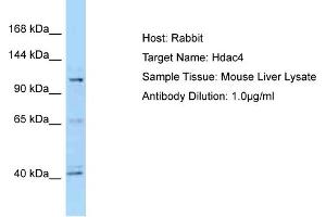 WB Suggested Anti-Hdac4 Antibody   Titration: 1. (HDAC4 anticorps  (C-Term))