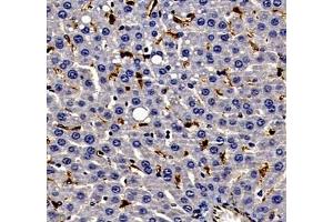 Immunohistochemistry of paraffin embedded rat liver using ANXA3 (ABIN7073065) at dilution of 1: 300 (400x lens)