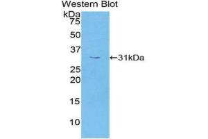 Detection of Recombinant PRKAg1, Human using Polyclonal Antibody to Protein Kinase, AMP Activated Gamma 1 (PRKAg1) (PRKAG1 anticorps  (AA 70-300))