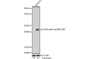Western blot analysis of extracts of NIH/3T3 cells, using Phospho-HP1 gamma/CBX3-S83 antibody (ABIN7266358) at 1:1000 dilution. (CBX3 anticorps  (pSer83))
