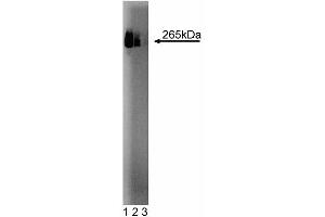 Western blot analysis of Fatty Acid Synthase on HepG2 cell lysate. (Fatty Acid Synthase anticorps  (AA 9-202))