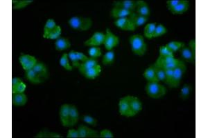 Immunofluorescence staining of HepG2 cells with ABIN7174103 at 1:266, counter-stained with DAPI.