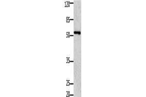 Western Blotting (WB) image for anti-GDNF Family Receptor alpha 1 (GFRA1) antibody (ABIN2431438) (GFRA1 anticorps)