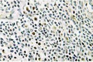 Immunohistochemistry (IHC) analyzes of NPM antibody in paraffin-embedded human tonsil tissue. (NPM1 anticorps)