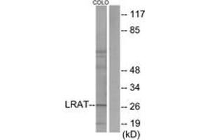 Western blot analysis of extracts from COLO205 cells, using LRAT Antibody. (LRAT anticorps  (AA 111-160))