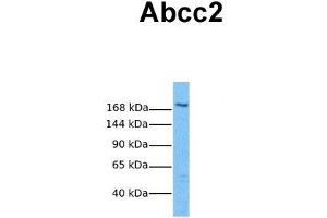 Host:  Rabbit  Target Name:  Abcc2  Sample Tissue:  Mouse Thymus  Antibody Dilution:  1. (ABCC2 anticorps  (Middle Region))