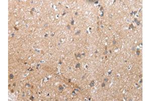 The image on the left is immunohistochemistry of paraffin-embedded Human brain tissue using ABIN7193075(XKR4 Antibody) at dilution 1/20, on the right is treated with synthetic peptide. (XKR4 anticorps)