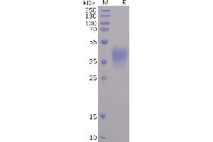 SARS-CoV-2 Spike-Membrane Recombinant Fusion Protein, His Tag on SDS-PAGE under reducing condition.