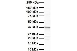 WB Suggested Anti-ERCC8 antibody Titration: 1 ug/mL Sample Type: Human liver