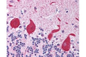Anti-TLR10 antibody IHC of human brain, cerebellum. (TLR10 anticorps)