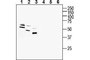 anti-G Protein-Coupled Receptor 160 (GPR160) (AA 122-136), (Intracellular) antibody