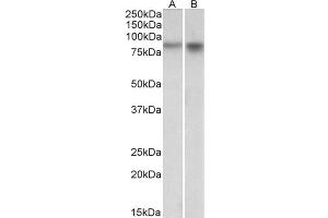 AP23231PU-N NPAS4 antibody staining of Mouse (A) and Rat (B) Brain lysates at 1 µg/ml (35µg protein in RIPA buffer). (NPAS4 anticorps  (Internal Region))