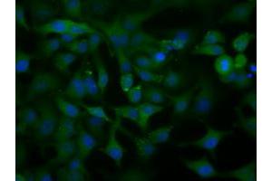 Image no. 10 for anti-Acetyl-CoA Acetyltransferase 2 (ACAT2) antibody (ABIN1496403) (ACAT2 anticorps)