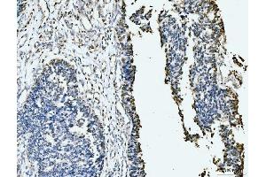 IHC analysis of MCM6 using anti-MCM6 antibody (ABIN7600038).