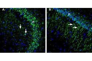 Expression of GIPC1 in mouse and rat hippocampus - Immunohistochemical staining of perfusion-fixed frozen mouse and rat brain sections with Anti-GIPC1 Antibody (ABIN7043215, ABIN7045188 and ABIN7045189), (1:200), followed by goat-anti-rabbit-AlexaFluor-488.