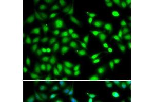 Immunofluorescence analysis of HeLa cells using CDKN2D Polyclonal Antibody (CDKN2D anticorps)