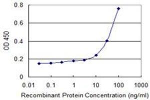 Detection limit for recombinant GST tagged EXOSC1 is 3 ng/ml as a capture antibody.