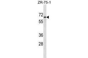 TM117 Antibody (C-term) western blot analysis in ZR-75-1 cell line lysates (35 µg/lane). (TMEM117 anticorps  (C-Term))