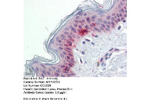 Immunohistochemistry with Human Skin lysate tissue at an antibody concentration of 5. (RAE1 anticorps  (C-Term))
