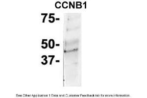 IP Suggested Anti-CCNB1 Antibody Positive Control: NT2 CELL/BRAIN TISSUE (Cyclin B1 anticorps  (C-Term))