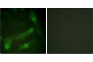 Immunofluorescence analysis of HeLa cells, using Smad2 (Phospho-Thr220) Antibody. (SMAD2 anticorps  (pThr220))