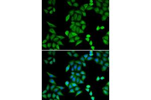 Immunofluorescence analysis of MCF-7 cells using RBPJ antibody (ABIN5973315). (RBPJ anticorps)