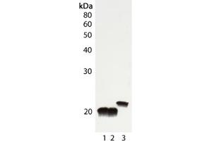 Western blot analysis of Cu/Zn SOD, pAb : Lane 1: Rat liver tissue lysate, Lane 2: Mouse liver tissue lysate, Lane 3: HeLa cell lysate . (SOD1 anticorps)