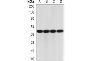 Western blot analysis of IL-23R expression in K562 (A), HepG2 (B), mouse intestine (C), mouse spleen (D) whole cell lysates.